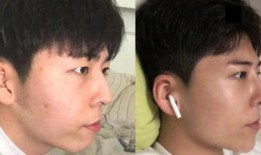 整形爆料视频大全,热门爆料视频大盘点